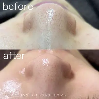 lulularico Yuのエステ・リラクイメージ