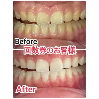 アイブロウ プラチナムビューティー柏所属・【歯科提携】柏ホワイ トニングスタイルのその他イメージ