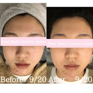 BestBelleꕤ 大阪福島/肌質改善のエステ・リラクイメージ