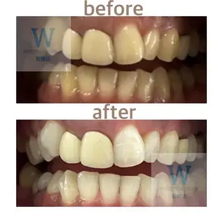 ホワイトニング ショップ船橋店🦷のエステ・リラクイメージ