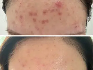 Facial Salon LUIRE所属・LUIRE　 ルイールのエステ・リラクイメージ