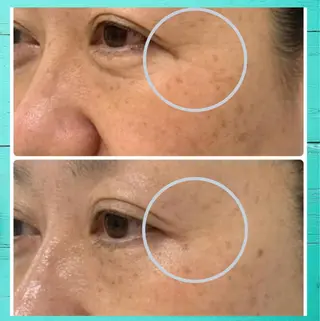 Lumiere despoir所属・Lumiere despoirのエステ・リラクイメージ