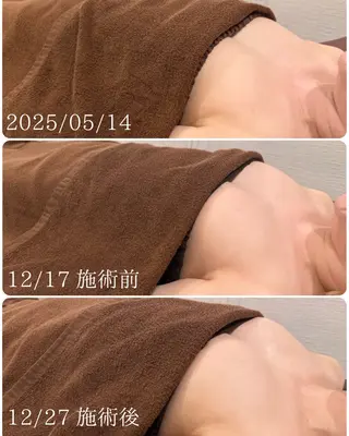 【Beauel】 あげはのエステ・リラクイメージ