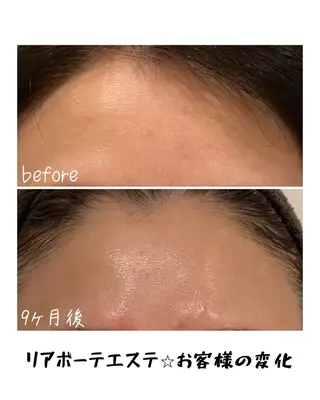 浜野 恵美のエステ・リラクイメージ