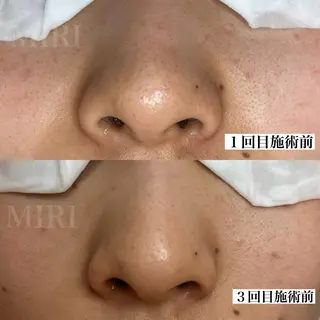 MIRI所属・北堀江/毛穴改善専門 ミリのエステ・リラクイメージ