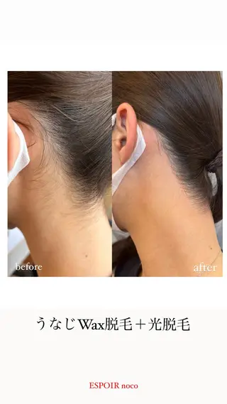 ワックス脱毛🌈 ESPOIRnocoのエステ・リラクイメージ