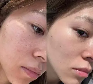 ネイル aliaハイフ&水光ジェットサロン所属・aliaハーブ水光店 エステティシャン募集のエステ・リラクイメージ