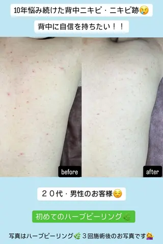 ベラージュ【美背中・ 美尻・フェイシャル】のエステ・リラクイメージ