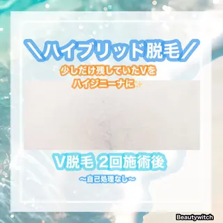 痩身/脱毛/ネイル HARUKAのエステ・リラクイメージ