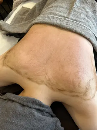 clé skin 🌿ハーブピーリングのエステ・リラクイメージ