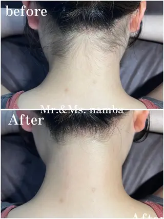 Mr.&Ms. 脱毛 /眉毛ワックス/まゆのエステ・リラクイメージ