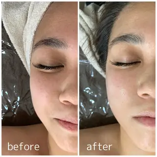 ビューティーサロンLEMO所属・ビューティーサロン Lemoのエステ・リラクイメージ