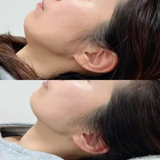 Liber Kyoto所属・魔法の シミ取り職人のエステ・リラクイメージ