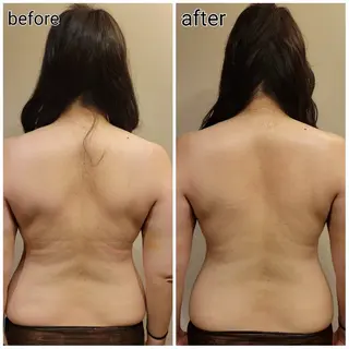 ラジオ波温活エステ✨ yumiのエステ・リラクイメージ