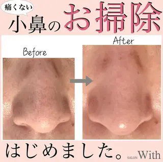 リラクゼーションサロンWith所属・古川 唯のエステ・リラクイメージ