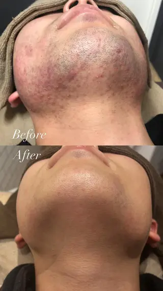 Lilyboo 多田のエステ・リラクイメージ