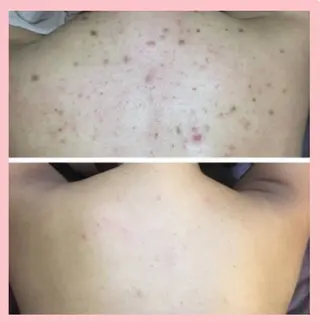 ハーブピーリング 専門店Kikkaのエステ・リラクイメージ