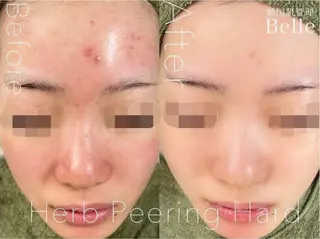 森 Belle目黒のエステ・リラクイメージ