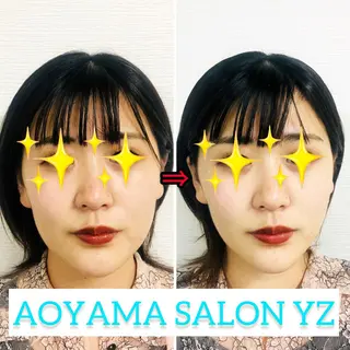 小顔美容鍼専門サロン 渋谷YZのエステ・リラクイメージ