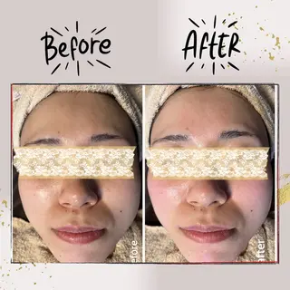 ピーリング専門店 Belluteのエステ・リラクイメージ