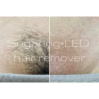 Sugaring / HILOT TAOのエステ・リラクイメージ