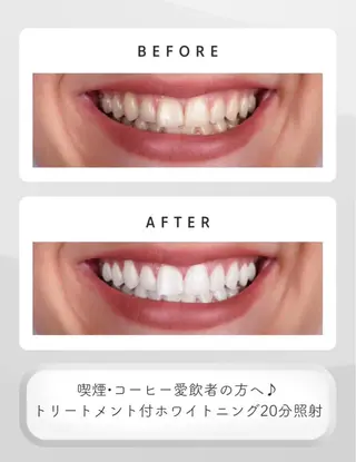 White33所属・aoi 🦷❤︎のその他イメージ