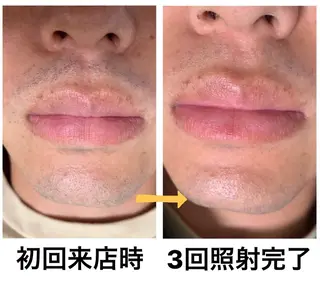 メンズ脱毛サロン Le falcoのエステ・リラクイメージ