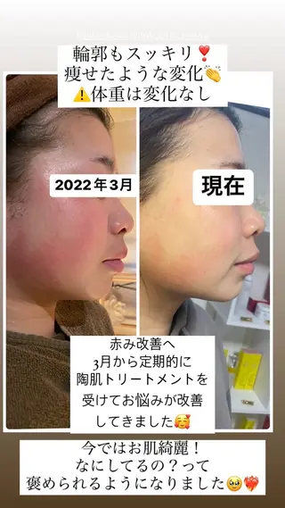 肌育脱毛サロン LikoLinaのその他イメージ