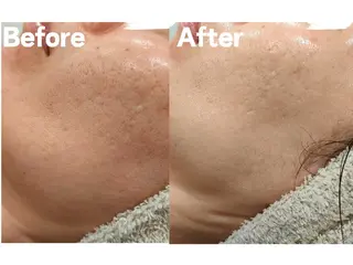 美肌脱毛＆小顔・フェ イシャル【SONA】のエステ・リラクイメージ