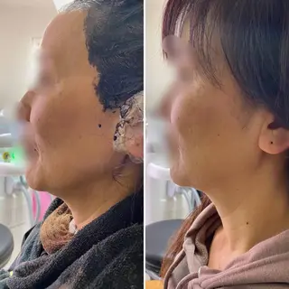 glosstokyo所属・縮毛矯正技師須藤玲人 髪質改善師ゴトウのヘアスタイル