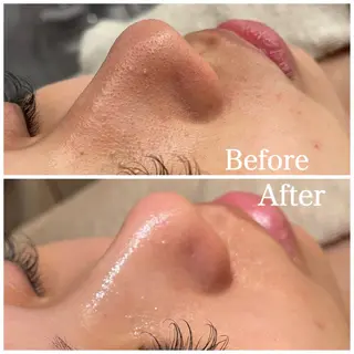 Nna Salon所属・Nna 🫧韓国肌管理🫧のエステ・リラクイメージ