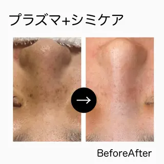 ハーブピーリング専門 muro.のエステ・リラクイメージ