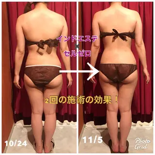 Cielo(シエロ) ダイエット専門店のエステ・リラクイメージ