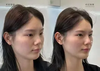 ネイル aliaハイフ&水光ジェットサロン所属・aliaハーブ水光店 エステティシャン募集のエステ・リラクイメージ