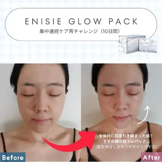 痩身ハーブピーリング 筋膜リリース☆B&Hのエステ・リラクイメージ