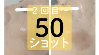 天使のしずく 神戸店所属・幹細胞エクソソーム 専門店 天使のしずくのその他イメージ