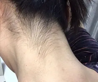 オーガニック エステ サロンフィオーレの眉毛・アイブロウイメージ