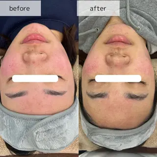 Venus所属・エステサロン Venusのその他イメージ