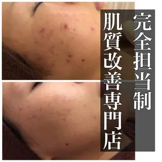 ミディアム カラー パーマ ヘアアレンジ メンズ キッズ ネイル マツエク・マツパ ニキビ・肌質改善専門 ♡人生が変わるサロンのエステ・リラクイメージ