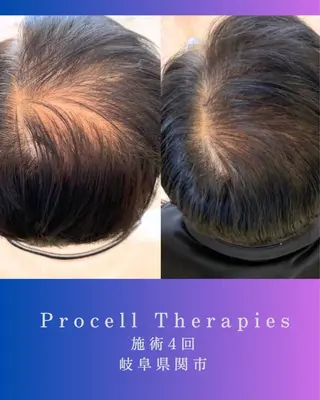 氣楽所属・松下 さゆりのエステ・リラクイメージ