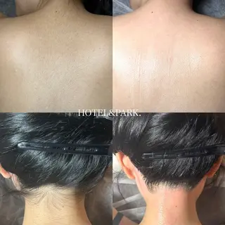 HOTEL&PARK .Moeワックス脱毛のエステ・リラクイメージ