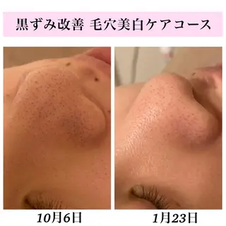 Bellesthe （ベルエステ）のエステ・リラクイメージ