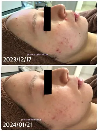 プライベートサロン Citrusのエステ・リラクイメージ