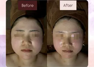 NOEL所属・NOEL まるこのエステ・リラクイメージ