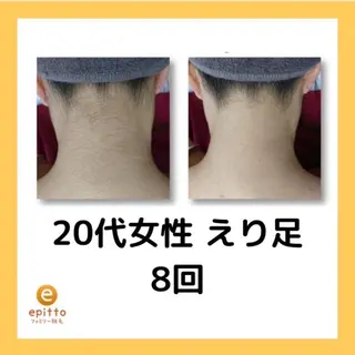 エピット横浜磯子店所属・エピット横浜磯子店 大森のエステ・リラクイメージ