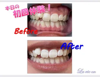 セルフホワイトニングサロン　ラヴィアン所属・ホワイトニングサロン La vie enのその他イメージ