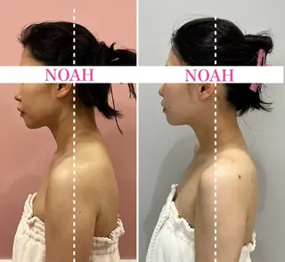 NOAH 小顔毛穴 川越店所属・NOAH ORIEのエステ・リラクイメージ