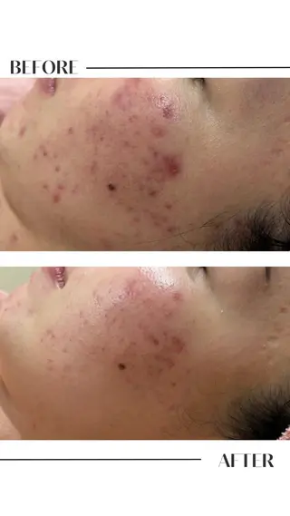 フェイシャル/脱毛 ジョアアンジェ　田中のエステ・リラクイメージ