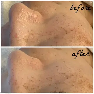 メンズ メナード岐阜市茜部 杉浦のエステ・リラクイメージ