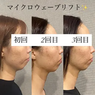 肌質改善専門 ハーブ /毛穴洗浄 リエイトのエステ・リラクイメージ